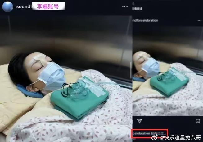 窦靖童为什么是兔嘴「李嫣晒唇腭裂手术照片真实」 建筑玻璃