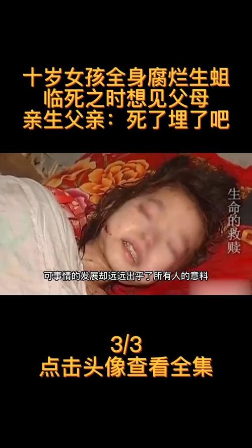 为什么人死后，会迅速的腐烂，发臭「家里刚死过人」 平板玻璃